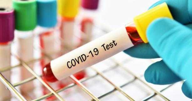 На Львівщині зафіксовано 19 нових випадків захворювання на коронавірус