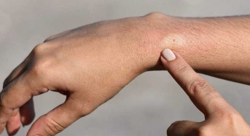 Близько 10 дітей пролікували у Західноукраїнському дитячому медцентрі від укусів змій: що важливо пам’ятати