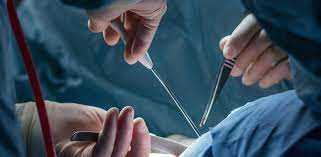 «Хірургія одного дня»: проведення нескладних операцій і виписка з лікарні протягом 24 годин