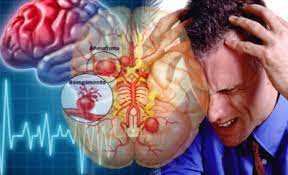 Домедична допомога при гострому мозковому інсульті: що важливо робити і від чого слід утриматися