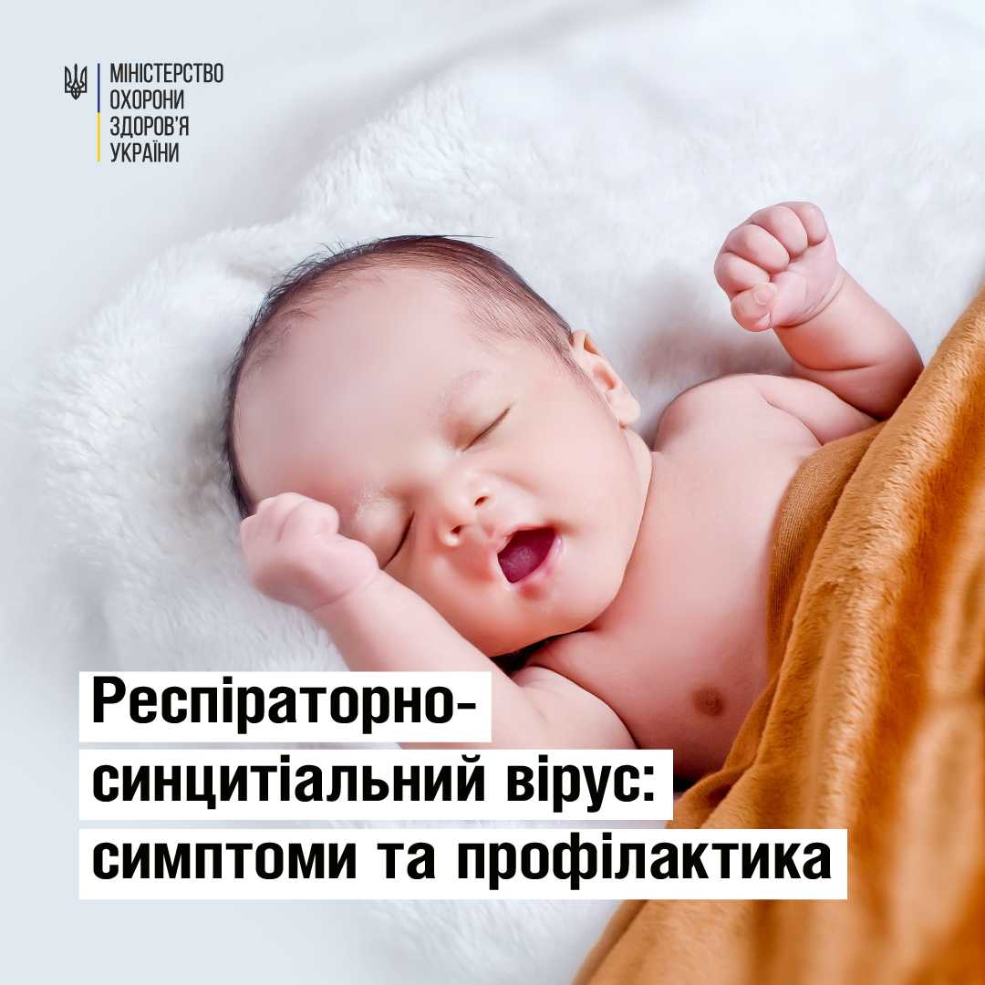 Респіраторно-синцитіальний вірус: симптоми та профілактика – МОЗ